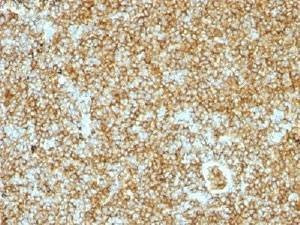 Anti-CD45RB Antibody