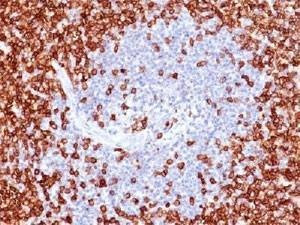 Anti-CD45RO Antibody