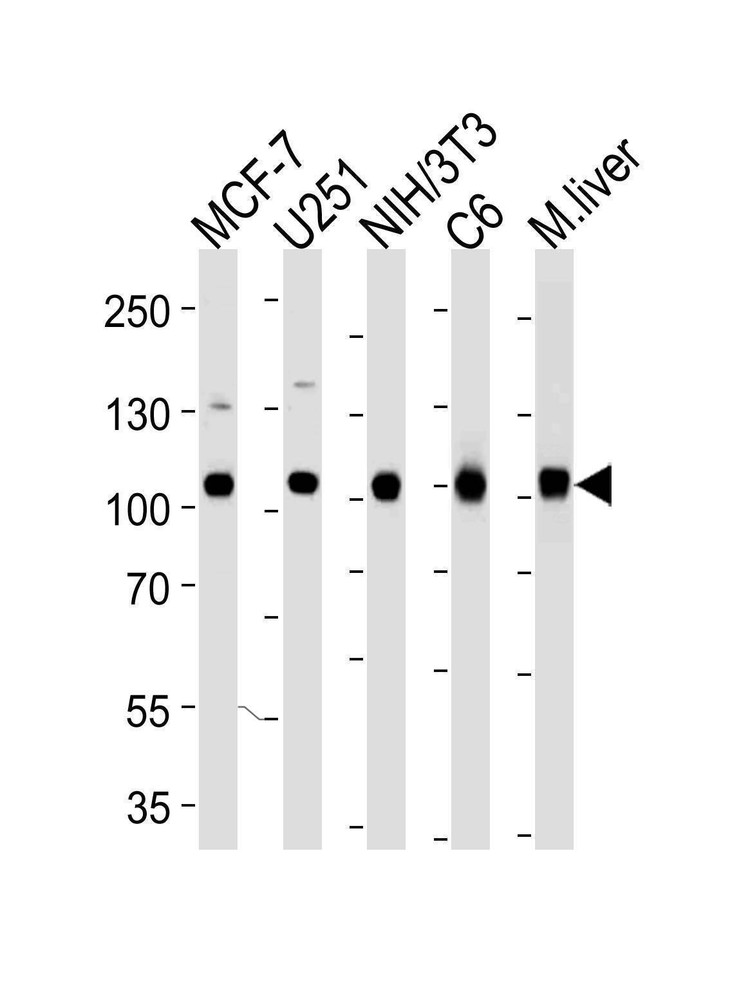 Anti-VCP Antibody