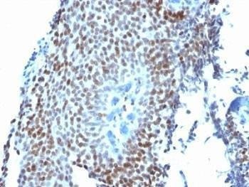 Anti-p21 Antibody, Sodium Azide Free