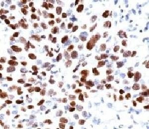Anti-p21 Antibody, Sodium Azide Free