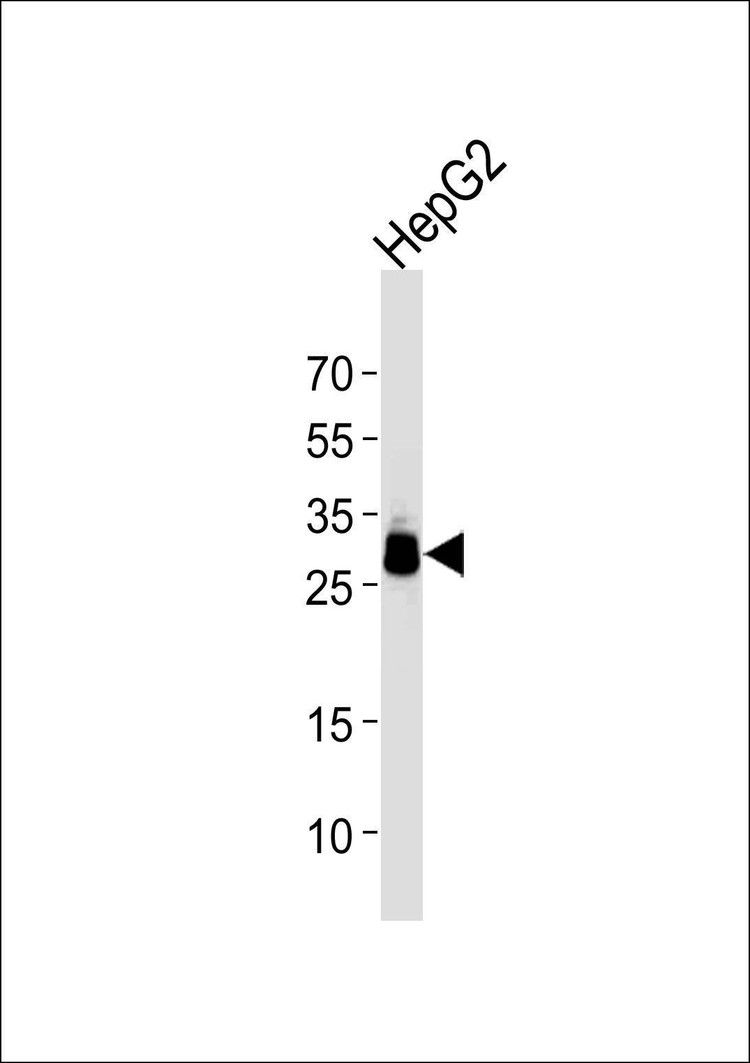 Anti-PPT1 Antibody