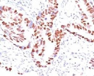 Anti-p57 Antibody, Sodium Azide Free