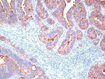 Anti-pan-CEA Antibody Cocktail