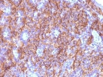Anti-Chromogranin A Antibody Cocktail