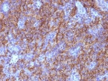 Anti-Chromogranin A Antibody