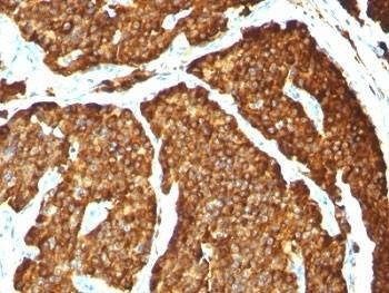 Anti-Chromogranin A Antibody