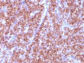 Anti-Chromogranin A Antibody