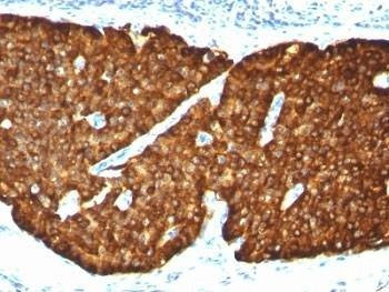 Anti-Chromogranin A Antibody