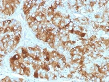 Anti-Chromogranin A Antibody