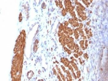 Anti-Calponin Antibody