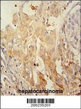 Anti-PINK1 Antibody