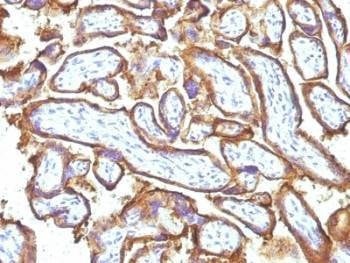 Anti-EGFR Antibody Cocktail