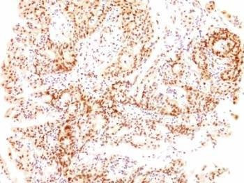 Anti-Estrogen Receptor beta Antibody, Sodium Azide Free