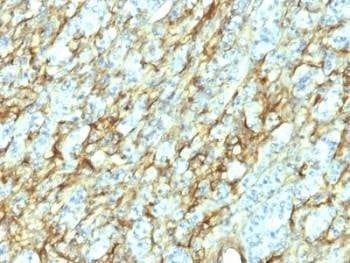 Anti-Fibronectin Antibody, Sodium Azide Free