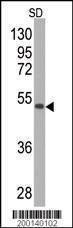 Anti-SOD2 Antibody