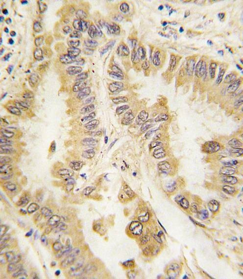 Anti-SOD2 Antibody