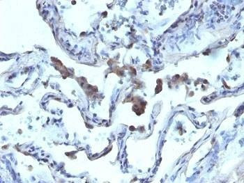 Anti-AMACR Antibody, Sodium Azide Free