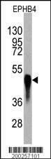 Anti-EPHB4 Antibody