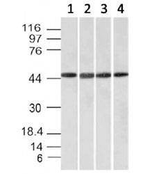 Anti-EMI1 Antibody