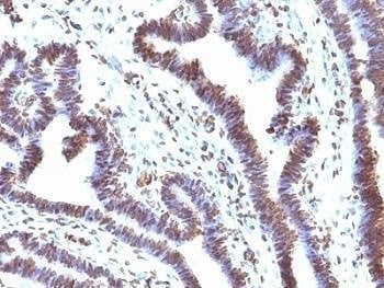 Anti-EMI1 Antibody, Sodium Azide Free