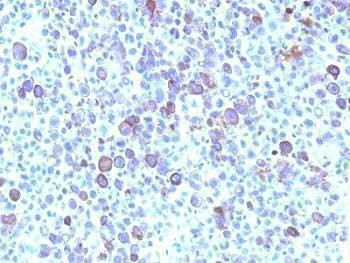 Anti-Glypican-3 Antibody, Sodium Azide Free