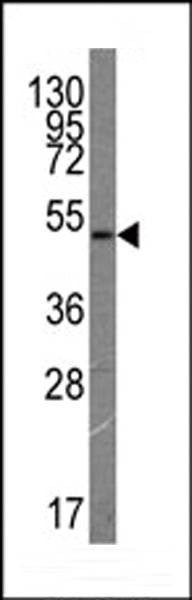 Anti-VGFR3 Antibody