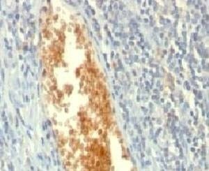 Anti-AMPD3 Antibody, Sodium Azide Free