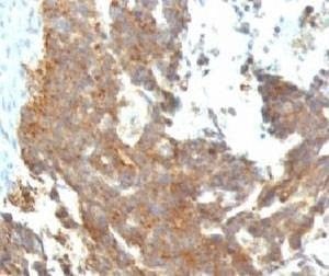 Anti-GnRH Receptor Antibody