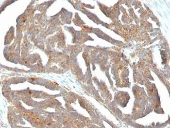 Anti-GnRH Receptor Antibody, Sodium Azide Free