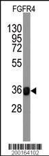 Anti-FGFR4 Antibody