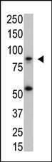 Anti-IKK beta Antibody