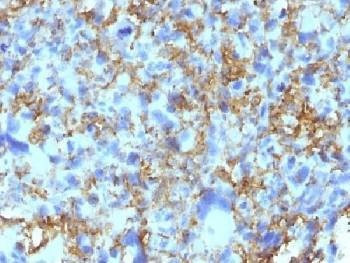 Anti-HLA-DRB1 Antibody (MHC II)