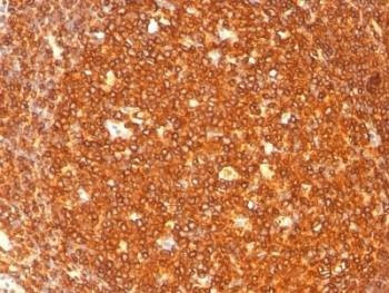 Anti-HLA-DRB1 Antibody (MHC II), Sodium Azide Free