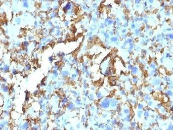 Anti-HLA-DRB1 Antibody (MHC II)