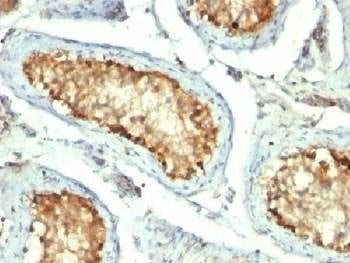 Anti-HSP60 Antibody (GROEL)