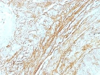 Anti-Tenascin C Antibody