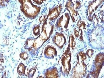 Anti-PSA Antibody Cocktail