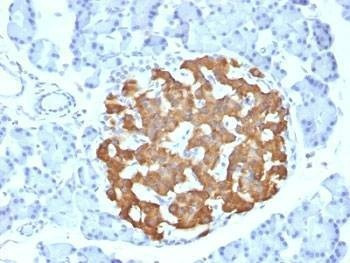 Anti-Pig/Mouse/Rat Insulin Antibody