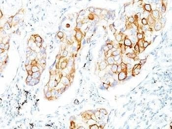 Anti-Cytokeratin 7 Antibody, Sodium Azide Free