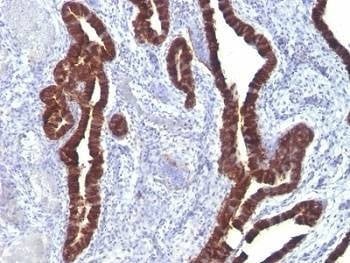 Anti-Keratin 7 Antibody, Sodium Azide Free