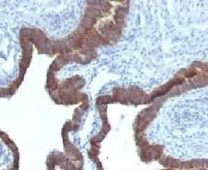 Anti-Cytokeratin 7 Antibody