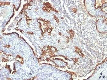 Anti-Cytokeratin 7 Antibody Cocktail, Sodium Azide Free