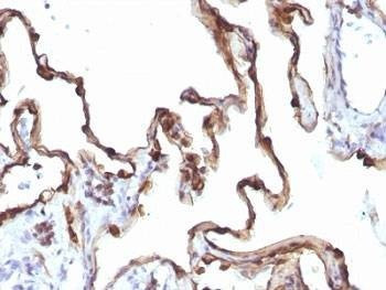 Anti-Keratin 7 Antibody, Sodium Azide Free