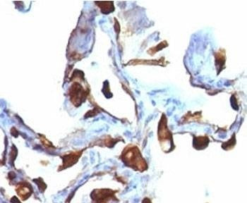 Anti-Keratin 8 Antibody