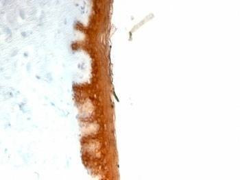Anti-Keratin 10 Antibody (KRT10)