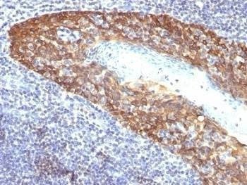 Anti-Keratin 14 Antibody (K14), Sodium Azide Free