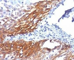 Anti-Cytokeratin 17 Antibody (KRT17)