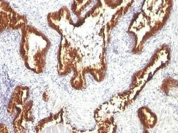 Anti-Keratin 18 Antibody, Sodium Azide Free