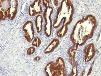 Anti-Cytokeratin 18 Antibody